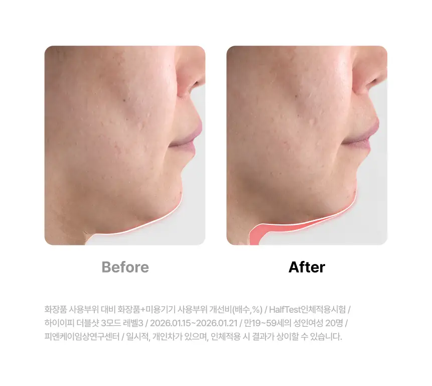 [홈케어/5분순삭,탄력흡수 더블케어] 듀얼소닉 하이이피 더블샷 (+비건콜라겐젤 정품 증정) 상세페이지 12